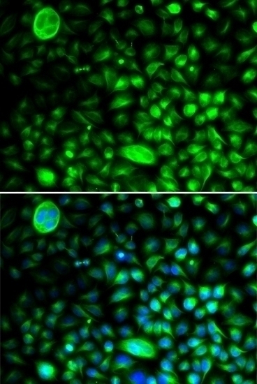 CACNG2 Antibody
