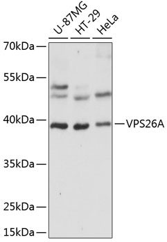 VPS26A Antibody