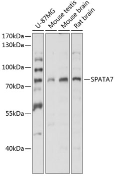 SPATA7 Antibody