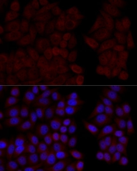 CALM1 Antibody