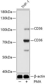 CD36 Antibody