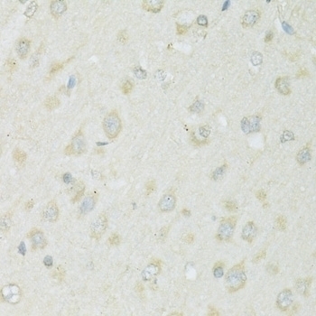 SLC22A5 Antibody