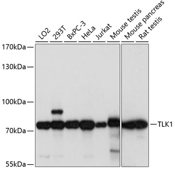 TLK1 Antibody