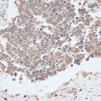 ZNF562 Antibody
