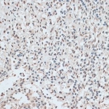 ZNF574 Antibody