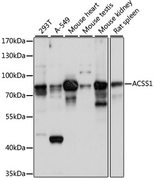 ACSS1 Antibody