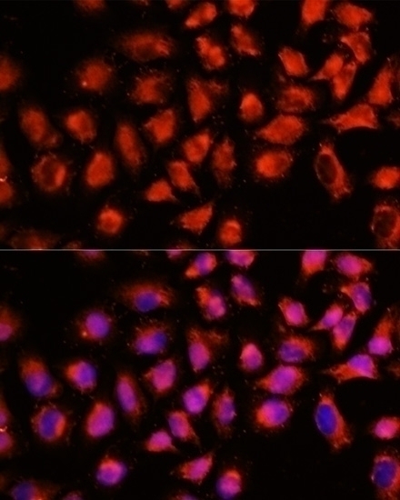 ADAM8 Antibody