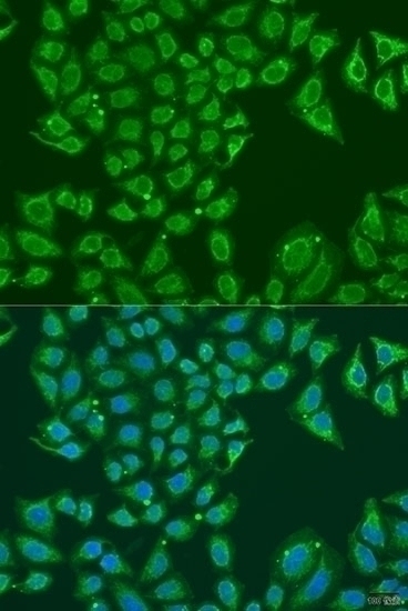 ALDH1B1 Antibody