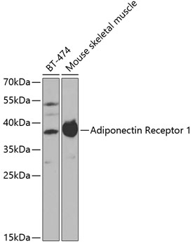 Adiponectin Receptor 1 Antibody