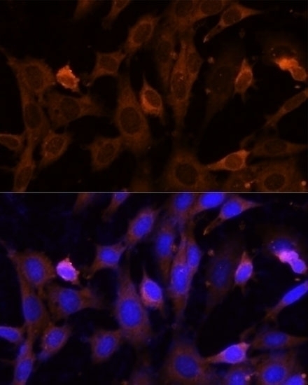 VPS36 Antibody