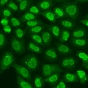 TERF2IP Antibody