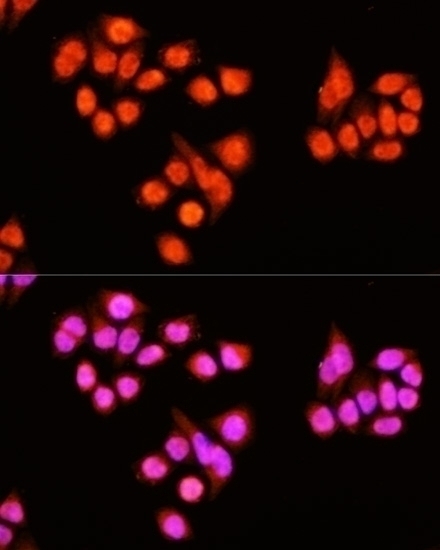 ZNF408 Antibody