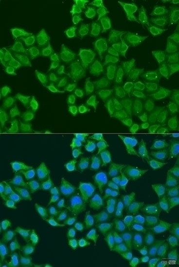 ULBP2 Antibody