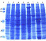 Coomassie blue staining of mouse tissue lysates in 10% SDS-PAGE. Lanes: 1, protein markers; 2, brain; 3, colon; 4, heart; 5, kidney; 6, liver; 7, lung; 8, pancreas; and 9, spleen.