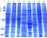 Coomassie blue staining of rat tissue lysates in 10% SDS-PAGE. Lanes: 1, protein markers; 2, rat rat adrenal; 3, cerebellum; 4, cerebrum; 5, small intestine; 6, skeletal muscle; 7, stomach; 8, testis; and 9, thymus