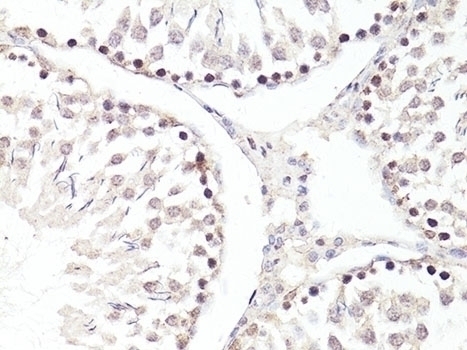 TWIST1 Antibody