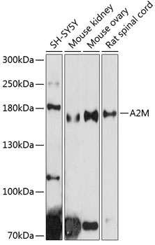 A2M Antibody