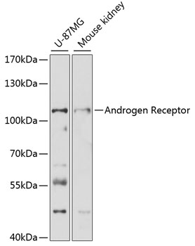 Androgen Receptor Antibody