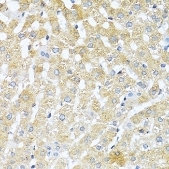 TGFB2 Antibody