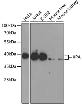 XPA Antibody, KO Validated