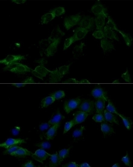 ATP6V0C Antibody