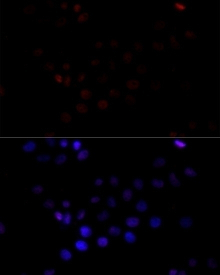 TBP Antibody