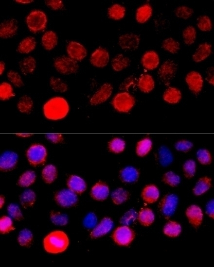BAZ1A Antibody