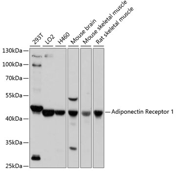 Adiponectin Receptor 1 Antibody