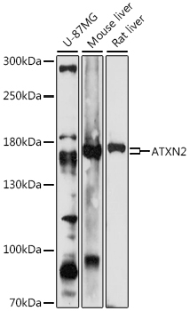 ATXN2 Antibody