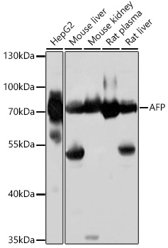 AFP Antibody