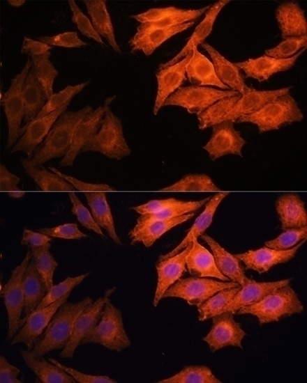 EGFR Antibody