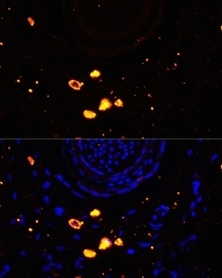 TYR Antibody