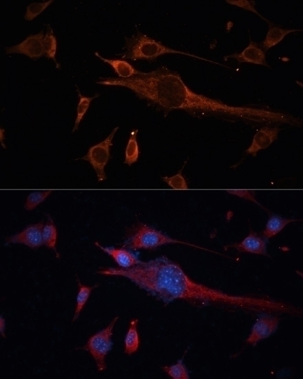 TUBB3 Antibody