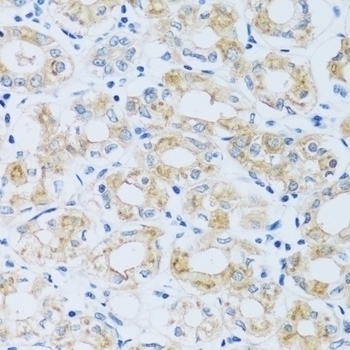 ARPC1A Antibody