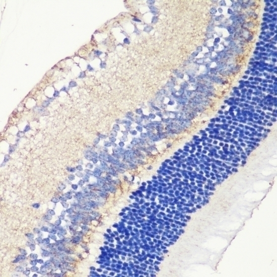 TRPM1 Antibody