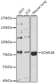 SCNN1B Antibody