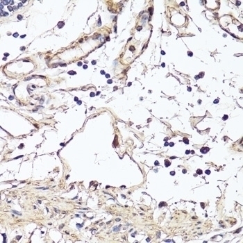 VEGF Antibody [5E5E3]