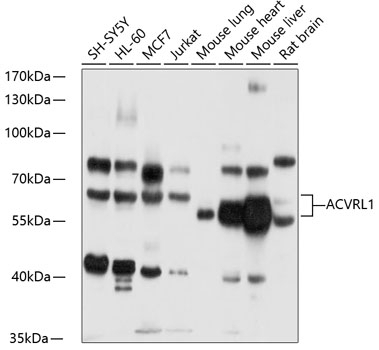 ACVRL1 Antibody