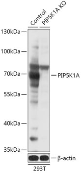 PIP5K1A Antibody, KO Validated