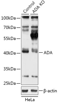 ADA Antibody, KO Validated