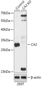 CA2 Antibody, KO Validated