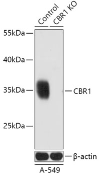 CBR1 Antibody, KO Validated