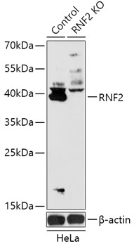 RNF2 Antibody, KO Validated