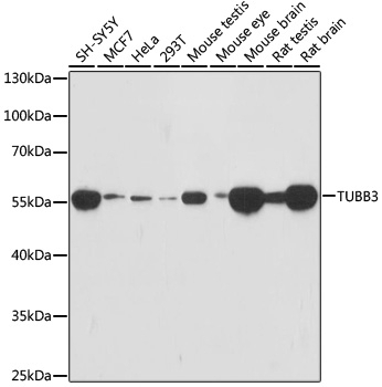 TUBB3 Antibody [5D5D2]