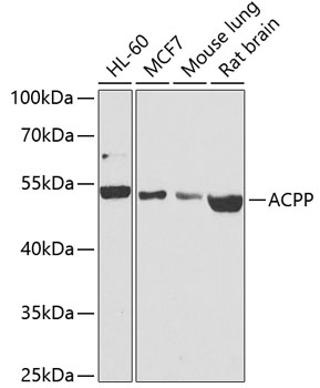 ACPP Antibody