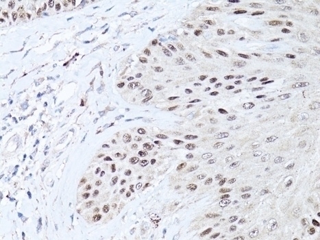 TP63 Antibody
