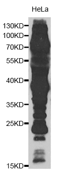 Pan Acetyl-Lysine pAb