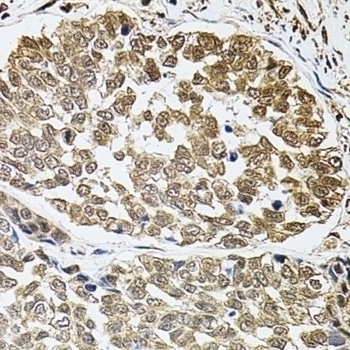 c-Fos Antibody