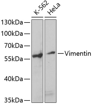 Vimentin Antibody