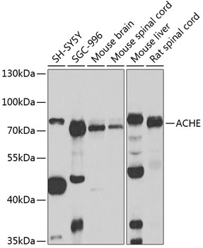 ACHE Antibody